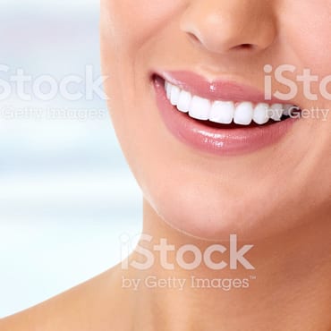 Before and after image of beautiful woman with white teeth