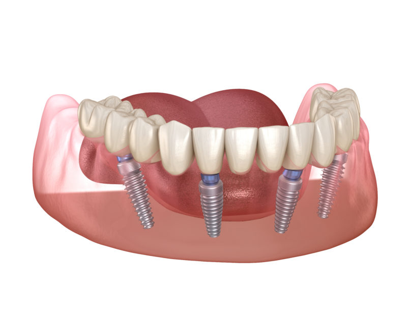 Latest Technology Used in Cosmetic Dentistry