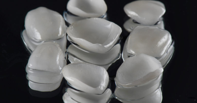 How Long Do Porcelain Veneers Last?