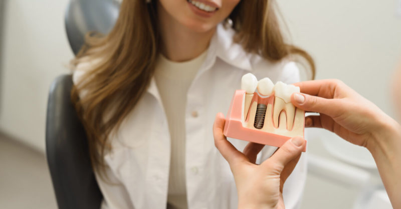 Am I a Candidate for Dental Implants?